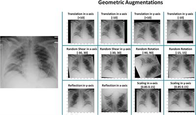 The Effectiveness of Image Augmentation in Deep Learning Networks for Detecting COVID-19: A Geometric Transformation Perspective